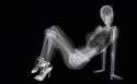 x-ray.jpg
