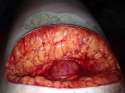 smalllaceration.jpg