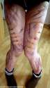 bandaidsmakeeverythingbetter.jpg