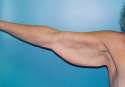 Flabby-arms.png