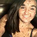 NewHaircutWillDistractFromMySpots.jpg