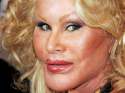 bad-plastic-surgery07.jpg