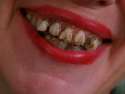 teeth.jpg