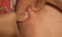 zit4.gif