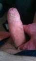 foreskin.jpg