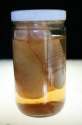 penis-jar-199x300.jpg