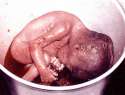 aborted-baby-in-bucket[1].jpg