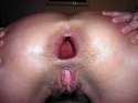 gaping-holes-7.jpg