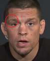 2016-03-06 17_27_31-Conor McGregor and Nate Diaz join FOX Sports Live - YouTube.jpg
