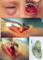 botfly.jpg