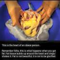 THIS IS A FAT HEART HEALTH IS NOT AT EVERY SIZE CUT DOWN O NTHE FRIRES.jpg