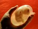 fetus.jpg