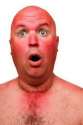 twinlab-niacin-review-niacin-flush.jpg
