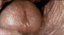 view from OP's larynx.gif