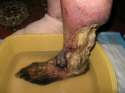 eating-flesh-medication-krokodil-finally-hit-us.jpg