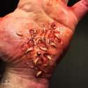 tryphophobia6.jpg