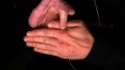 THUMB REMOVAL.gif