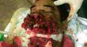 tried-suicide-by-swallowing-bomb1-550x300.jpg