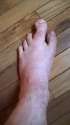 foot.jpg