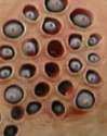 breast-rash2.jpg