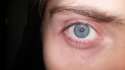 eye.jpg