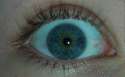 Eyeball.jpg