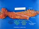 Rectum_lateral_view.jpg