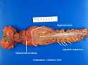 Rectum_anterior_view.jpg