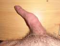 foreskinpenis.jpg