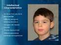 fetal-alcohol-syndrome-presentation-6-728.jpg