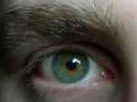 eye.jpg