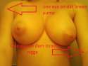 breast.jpg