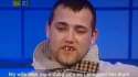 bad-teeth.jpg