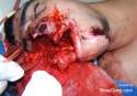 failed-suicide-brazilian-soldier-gore-04.jpg