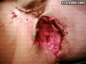 26-asshole-ripped-open.jpg