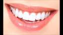 teeth1.jpg