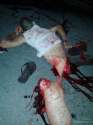 two-guy-chop-up-crash-motorcycle-headon-car-brazil-09-768x1024.jpg