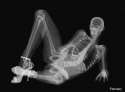 sexy_x_ray_february.jpg