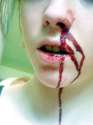 bleedingWoops.jpg