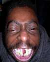 Ugly-and-Weird-People-Ugly-Teeth-02.jpg