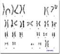 p_chromosome_female_01.jpg