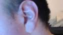 hanging earlobe.jpg