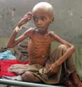 Somalia_East_Africa_Famine_0ab5d.jpg