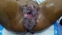 Blue-Waffle-Pictures-3.jpg