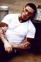vitiligo black skin condition white..jpg