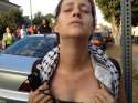 Trayvon-protester-shows-rubber-bullet-marks.jpg