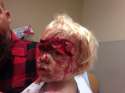 Pitbull attacks 3 year old, real smart dogs.jpg