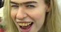 method=get&rs=96&q=75&x=-2&y=157&w=310&h=165&ro=0&s=british-bad-teeth.jpg