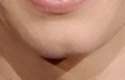 chin2_e.jpg