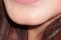 chin1_e.jpg